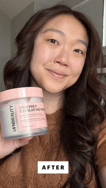 Lee after applying the InnBeauty Skin Prep Exfoliating Pads